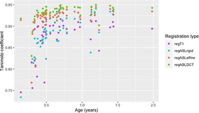 Using Perfusion Contrast for Spatial Normalization of ASL MRI Images in a Pediatric Craniosynostosis Population